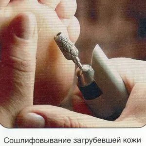 Аппаратный педикюр