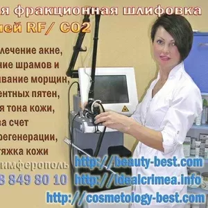 Красивые лицо и тело в любом возрасте фракционная шлифовка с функцией RF/CO2. Cимферополь