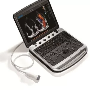 Аппарат УЗИ Chison SonoBook 9 с двумя датчиками