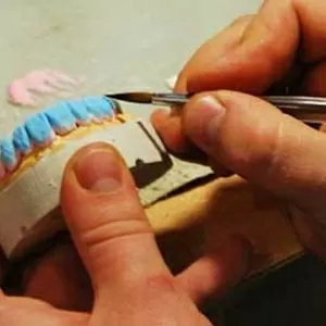 Требуется зубной техник-гипсовщик