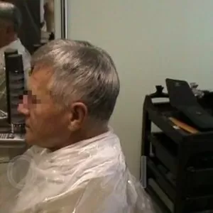 Безоперационное замещение волос